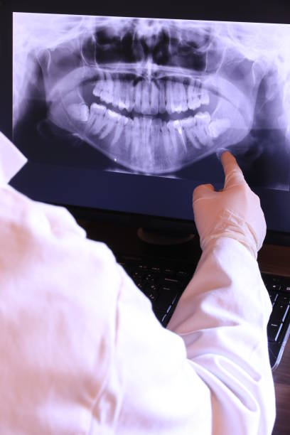 Best Emergency Dentist for Lost Fillings or Crowns in Silver Firs, WA