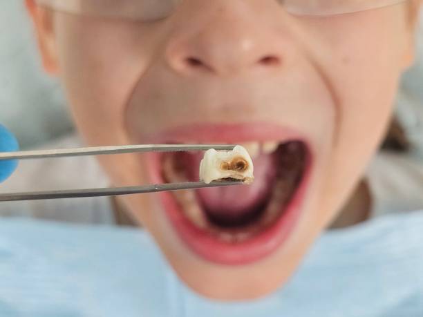 Best Orthodontic Emergency Dentist in Silver Firs, WA