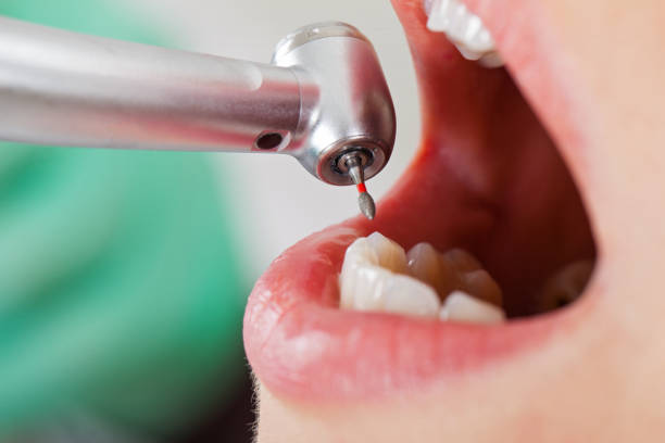 Best Emergency Dentist for Special Needs Patients in Silver Firs, WA